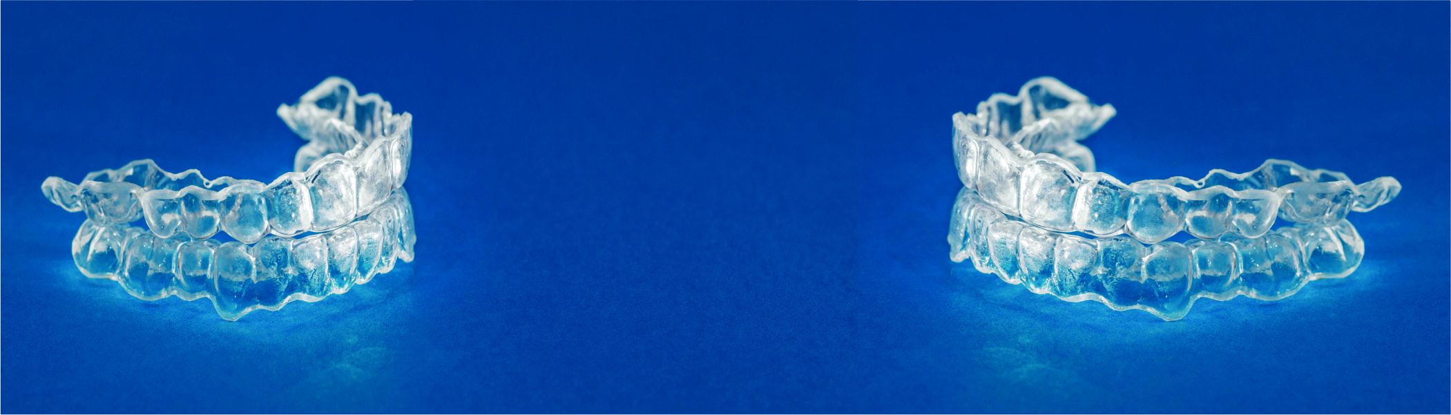 Conheça Mais sobre os Alinhadores Transparentes